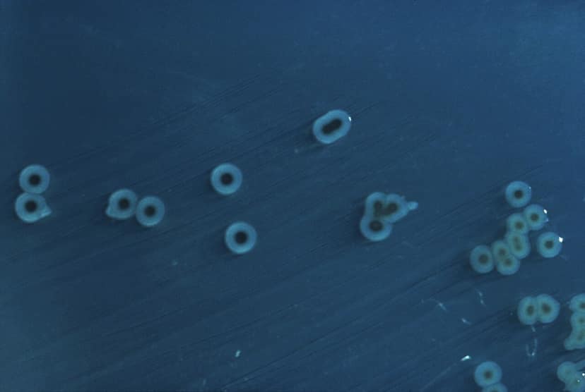 Camp concluded early after salmonella outbreak among seven Flemish youth