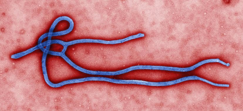 Foto de archivo: Ébola circuló cuatro meses antes de que se declarara la epidemia en RDCongo