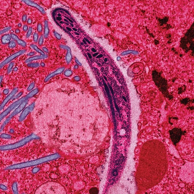 Archive photo: Two Frankfurt Airport Workers Die from Malaria