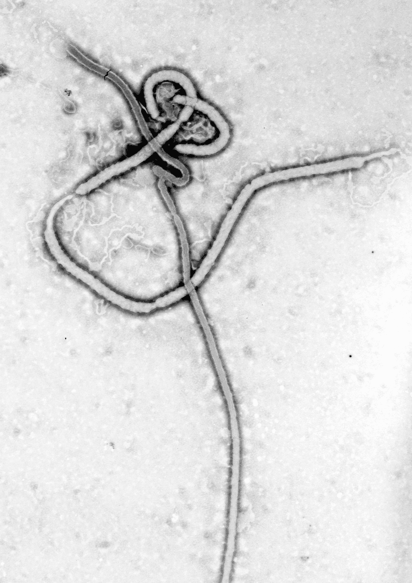 Foto de archivo: 70.000 dosis de la vacuna Ervebo contra el Ébola para la República Democrática del Congo