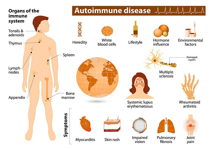 Photo d'archive: Le test NIPT peut prédire les complications gravidiques liées aux maladies auto-immunes