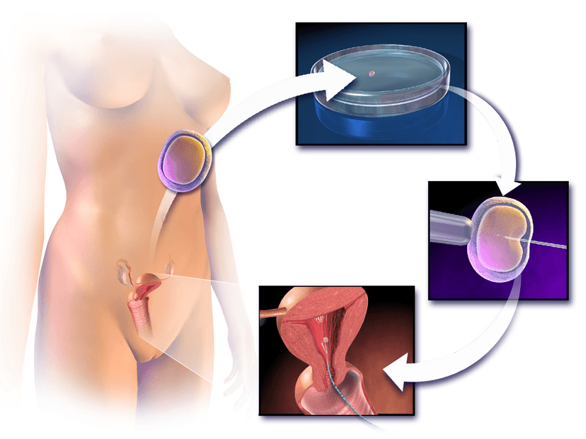 Photo d'archive: L'APF exige des garanties pour les patients d'une clinique de fertilité fermée