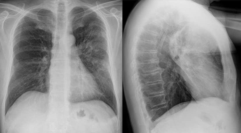 Foto de arquivo: Legionelose em Savóia: 46 casos e três óbitos desde junho