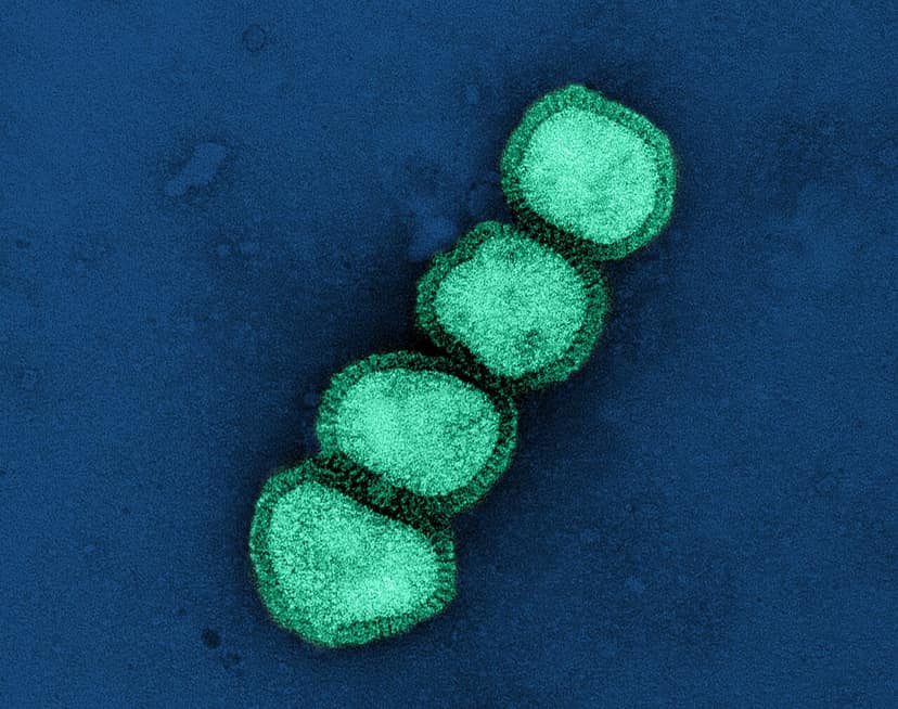 Foto de archivo: Aumento de casos de H1N1 provoca revisión de salud en Delhi
