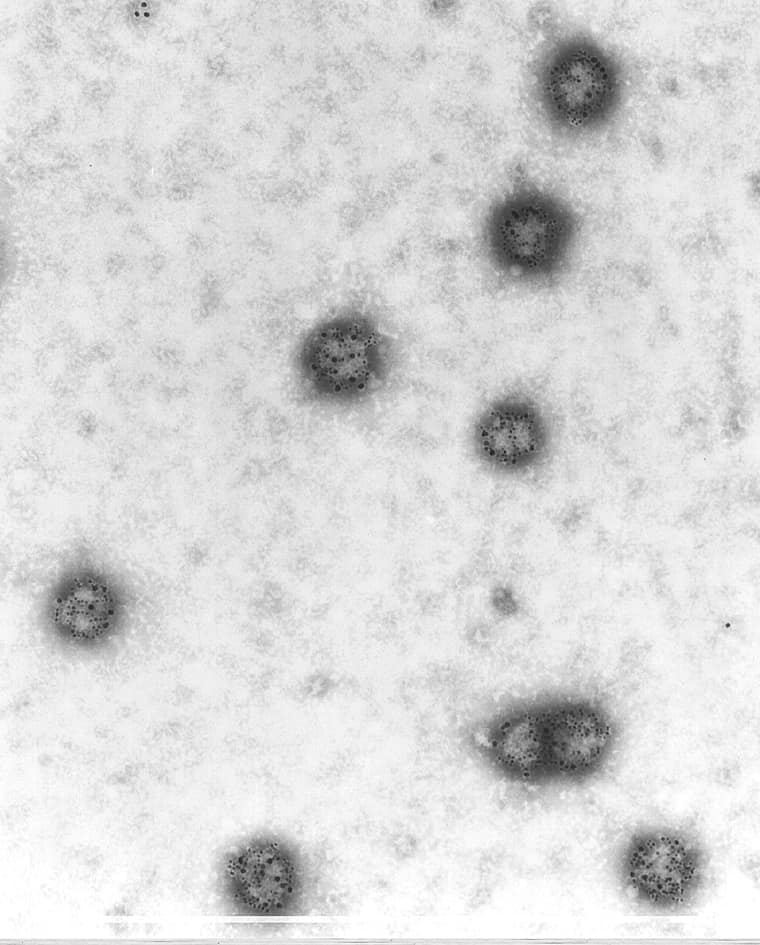 Foto de archivo: Francia confirma el primer caso humano del virus Shamonda; el paciente muere